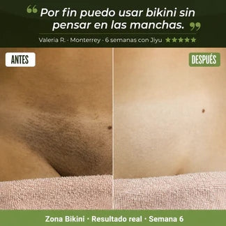 Toallitas Aclarantes