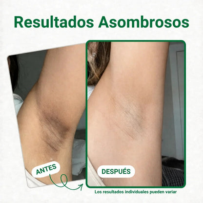 Toallitas Aclarantes